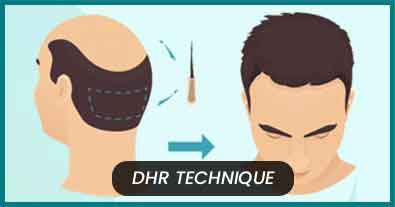 Best Hair Transplant in India | Best Hair Transplant Surgeon in india | Enhance  Clinic