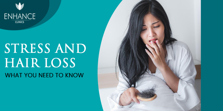 Stress and Hair Loss: What you Need to Know.