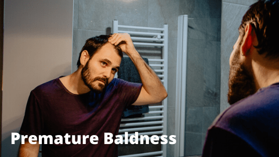 5 Reasons For Premature Baldness: Experience The Best Hair Loss Treatment