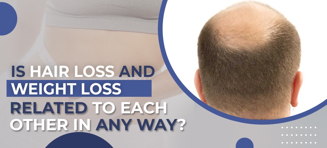 Is Hair Loss and Weight Loss related to each other in any way?