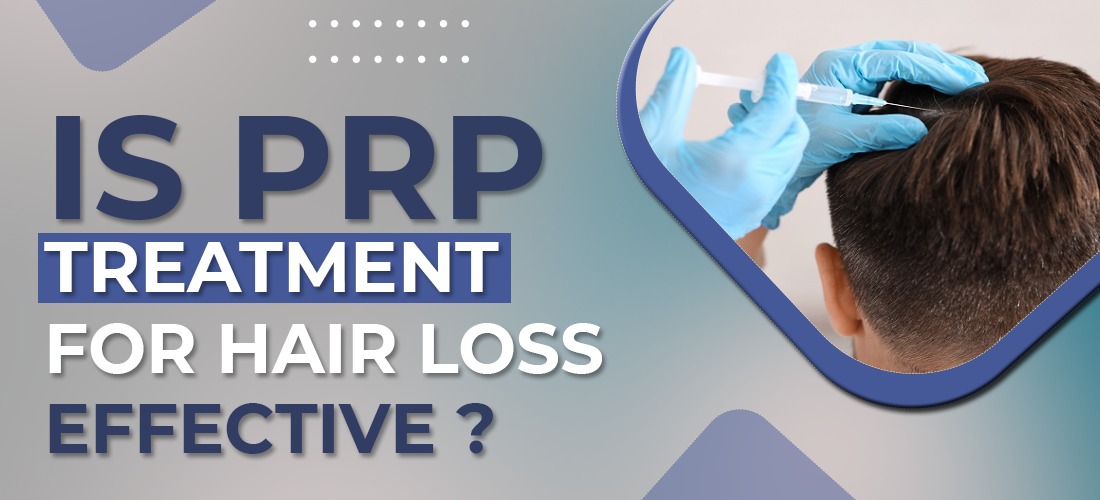 Is PRP Treatment For Hair Loss Effective?   