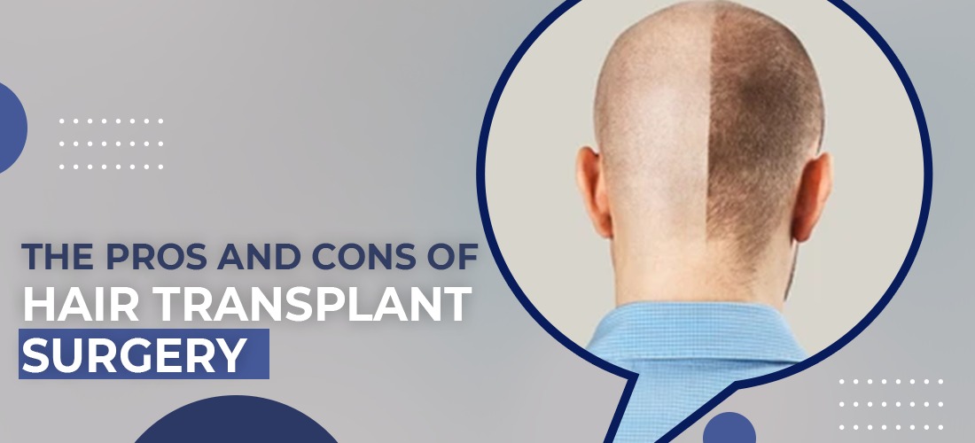 The pros and cons of hair transplant surgery: End results