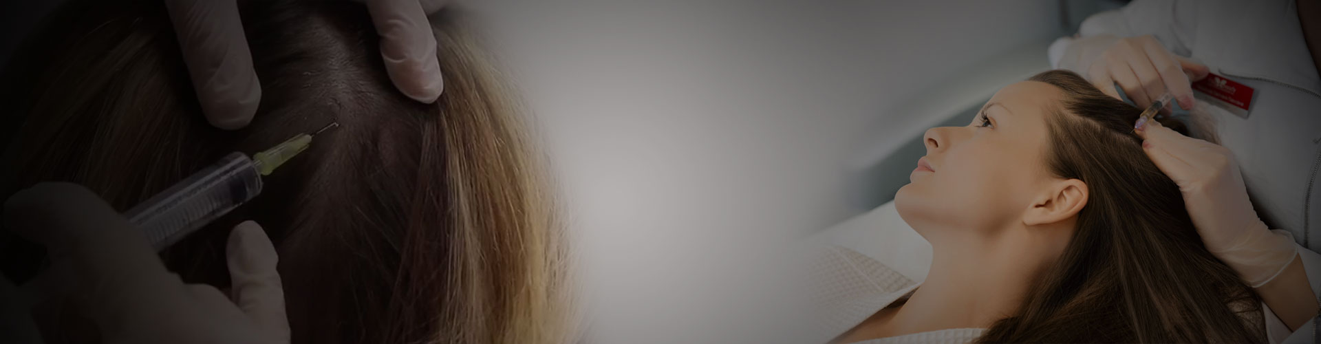 Mesotherapy in Delhi, Mesotherapy for Hair Loss, Mesotherapy Cost Mesotherapy in Delhi, Mesotherapy for Hair Loss, Mesotherapy Cost