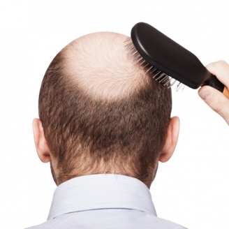 Hair Loss Treatment in Delhi 