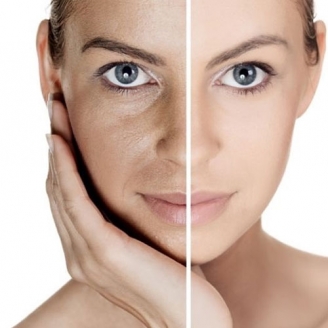 Skin Polishing Treatment in Delhi 