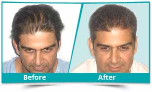 best hair treatment clinic